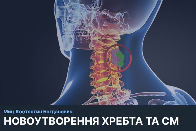Новоутворення хребта та спинного мозку консультація Київ