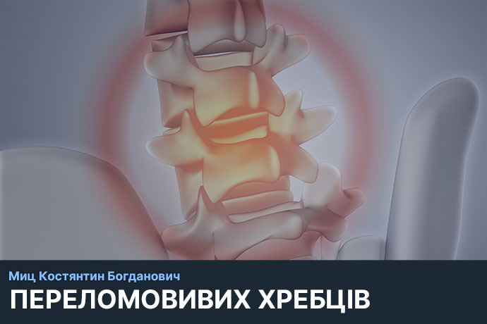 Вибухові переломи хребта консультація Київ